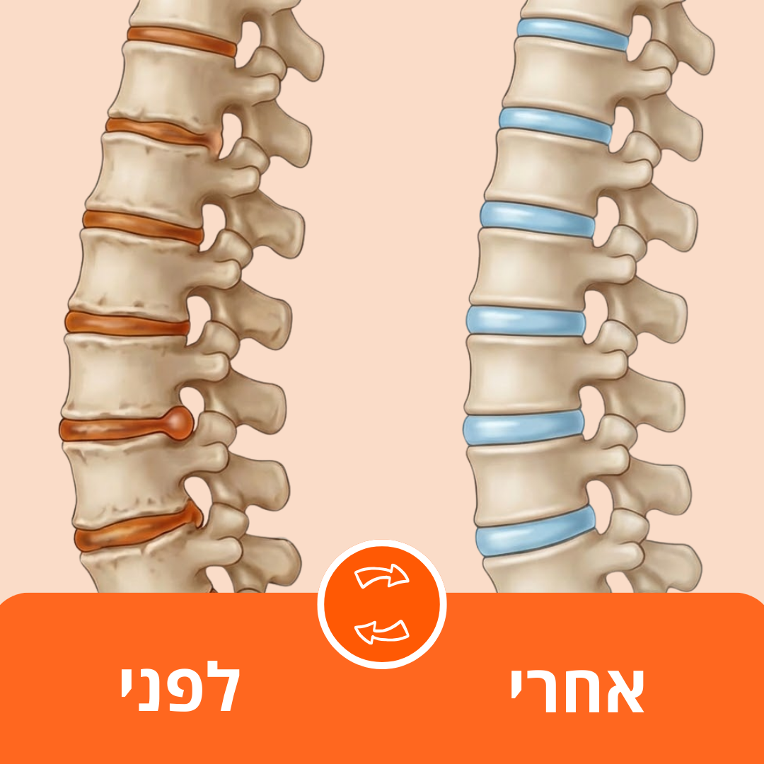 כרית טיפול הגב של וורזה